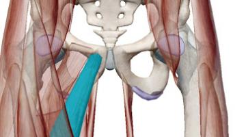 Lesion Muscular del Aductor