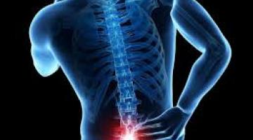 Dolor Lumbar