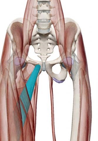 Lesion Muscular del Aductor