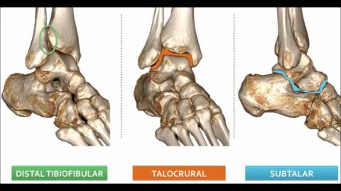 Biomecanica Articulacion Talocrural