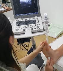 Fascia Plantar EPI